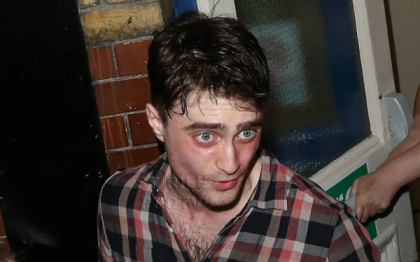 Nu poate nici sa-si lege sireturile. Cu ce probleme de sanatate se confrunta Harry Potter