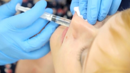 Ce spune patroana salonului, despre acuzatiile fetelor care se plang ca au mers sa-si mareasca buzele cu acid hialuronic acolo, insa li s-a injectat o alta substanta, care in timp s-a transformat in plastic Ce spune patroana salonului, despre acuzatiile fetelor care se plang ca au mers sa-si mareasca buzele cu acid hialuronic acolo, insa li s-a injectat o alta substanta, care in timp s-a transformat in plastic