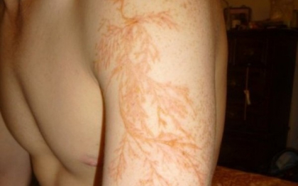 Pare un tatuaj, insa nu ti-ar trece niciodata prin minte ce este in realitate acest "desen" Pare un tatuaj, insa nu ti-ar trece niciodata prin minte ce este in realitate acest "desen"