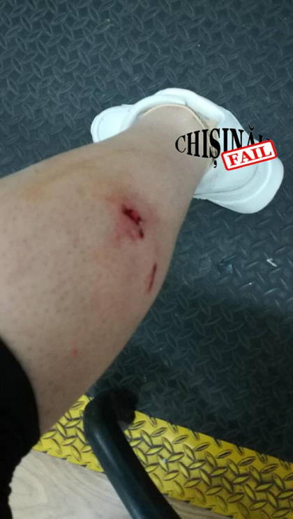 O femeie se plange pe internet ca a fost atacata si muscata de o haita de caini din capitala - FOTO O femeie se plange pe internet ca a fost atacata si muscata de o haita de caini din capitala - FOTO