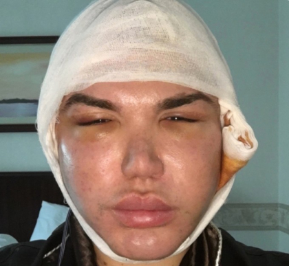 Papusa umana Ken, la un pas de moarte. Ce au descoperit medicii dupa ultima operatie estetica - GALERIE FOTO Papusa umana Ken, la un pas de moarte. Ce au descoperit medicii dupa ultima operatie estetica - GALERIE FOTO