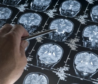 Un copil de un an si jumatate a ajuns la spital cu un bat infipt in creier. Reactia medicilor Un copil de un an si jumatate a ajuns la spital cu un bat infipt in creier. Reactia medicilor
