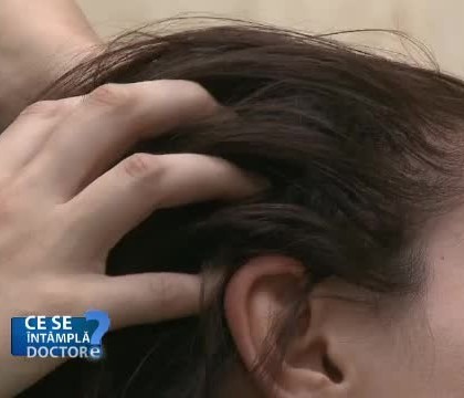 Tratamentele pe care le putem urma impotriva caderii parului Tratamentele pe care le putem urma impotriva caderii parului