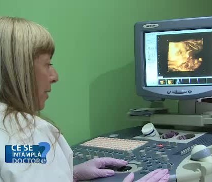 Care este cea mai frecventa tumora benigna in randul femeilor si ce trebuie sa faceti pentru a o diagnostica