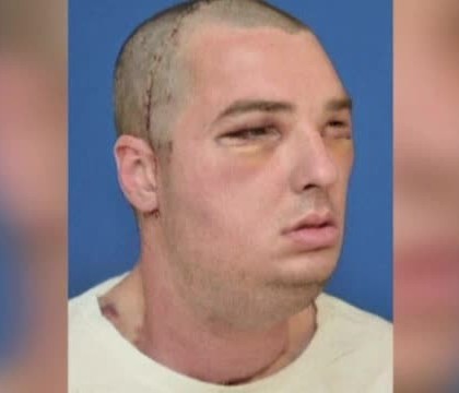 Timp de 15 ani a trait ca Fantoma de la Opera, ascunzandu-si chipul desfigurat. 150 de chirurgi s-au chinuit sa-i refaca fata Timp de 15 ani a trait ca Fantoma de la Opera, ascunzandu-si chipul desfigurat. 150 de chirurgi s-au chinuit sa-i refaca fata