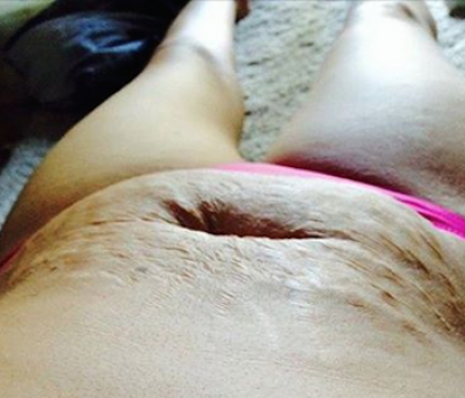 "Imi pare rau daca vi se pare dezgustator". Raspunsul femeii din fotografie pentru cei care au criticat-o a facut inconjurul lumii