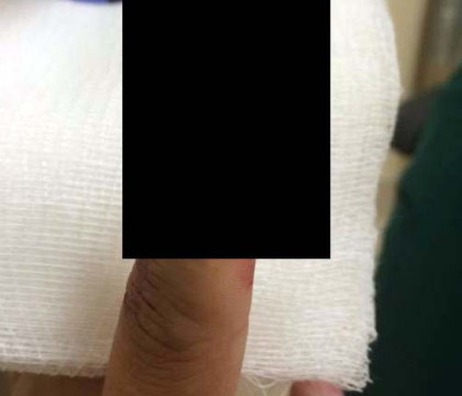 Incident grav la concertul lui Beyonce si Jay-Z. Ce a patit un tanar care a vrut sa isi apere iubita. FOTO Incident grav la concertul lui Beyonce si Jay-Z. Ce a patit un tanar care a vrut sa isi apere iubita. FOTO