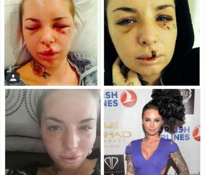Cum arata acum Christy Mack, actrita de filme XXX care a fost batuta crunt de catre iubitul ei, War Machine Cum arata acum Christy Mack, actrita de filme XXX care a fost batuta crunt de catre iubitul ei, War Machine