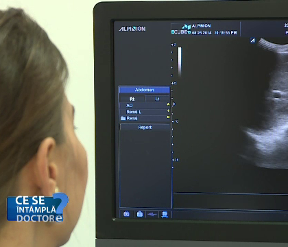 Mergeti la doctor daca durerile menstruale nu cedeaza la antiinflamatoare. Afectiunea grava care poate duce la infertilitate Mergeti la doctor daca durerile menstruale nu cedeaza la antiinflamatoare. Afectiunea grava care poate duce la infertilitate