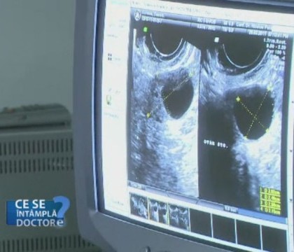 Durerile din prima zi de menstruatie sunt un semn BUN. Ce spun despre sanatatea femeilor Durerile din prima zi de menstruatie sunt un semn BUN. Ce spun despre sanatatea femeilor