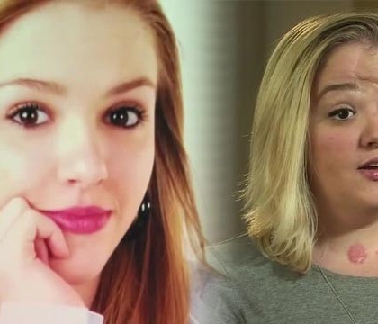 Cosmarul unei victime a SMS-urilor la volan. O tanara din SUA le da sfaturi adolescentilor dupa un accident ingrozitor Cosmarul unei victime a SMS-urilor la volan. O tanara din SUA le da sfaturi adolescentilor dupa un accident ingrozitor