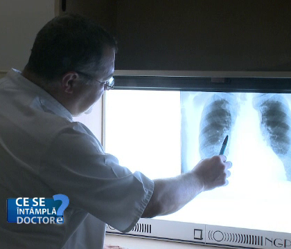 Astmul, boala de care sufera 230 de milioane de oameni. Primele simptome care ar trebui sa va trimita la medic Astmul, boala de care sufera 230 de milioane de oameni. Primele simptome care ar trebui sa va trimita la medic