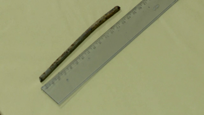 Un barbat din Polonia a ajuns constient la spital cu un cui de 15 centimetri in craniu. Cum a decurs interventia medicala Un barbat din Polonia a ajuns constient la spital cu un cui de 15 centimetri in craniu. Cum a decurs interventia medicala