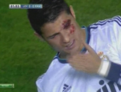 Mii de fani au inmarmurit cand l-au vazut plin de sange! Accidentarea teribila a lui Cristiano Ronaldo