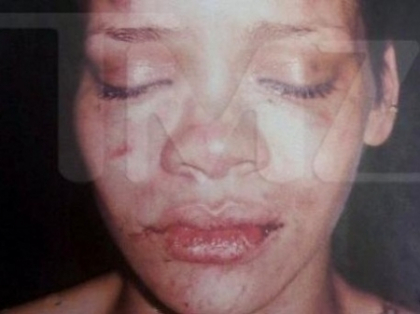 Rihanna s-a impacat cu cel care a batut-o crunt? Chris Brown, cu pantalonii in vine -FOTO