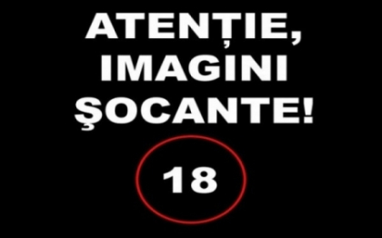 IMAGINI SOCANTE. O fetita de 4 ani a supravietuit miraculos dupa ce i-a intrat o surubelnita in fata