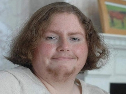 Nu-si rade barba de o luna! Cum arata o englezoaica, diagnosticata cu sindromul ovarelor polichiste