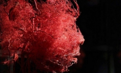 Descoperirea care ar putea salva vietile a sute de mii de oameni. Aparatul identifica din timp atacurile cerebrale Descoperirea care ar putea salva vietile a sute de mii de oameni. Aparatul identifica din timp atacurile cerebrale