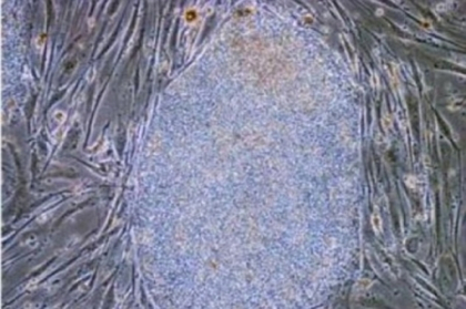 Descoperire de senzatie a cercetatorilor japonezi. Este un pas urias in lupta cu cancerul Descoperire de senzatie a cercetatorilor japonezi. Este un pas urias in lupta cu cancerul