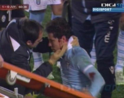 Accidentare horror in Cupa Italiei! Un jucator de la Lazio si-a pierdut cunostinta dupa acest moment