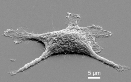 Cercetatorii au creat celule "zombie", capabile sa supravietuiasca la presuni si temperaturi extreme