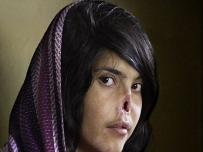Iti amintesti de tanara afgana ramasa fara nas? Cum arata dupa ultima interventie medicala - FOTO Iti amintesti de tanara afgana ramasa fara nas? Cum arata dupa ultima interventie medicala - FOTO