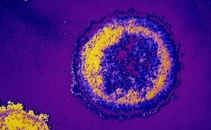 Un nou tratament impotriva virusului HIV. Medicii sustin ca veninul de albine este solutia

