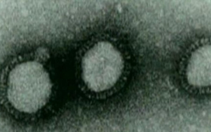 Un virus mortal a pus in alerta autoritatile britanice, dupa ce un alt pacient infectat a murit