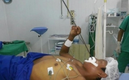 Un pescar a ajuns la spital cu o sageata infipta in cap, dupa ce a fost confundat cu un peste