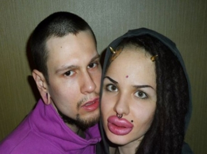 Sexy sau de groaza? Cum arata fata cu cele mai mari buze din lume - GALERIE FOTO Sexy sau de groaza? Cum arata fata cu cele mai mari buze din lume - GALERIE FOTO
