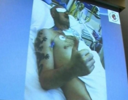 A primit o fata noua, la doar trei luni dupa ce i-a fost desfigurat craniul! E primul asemenea transplant
