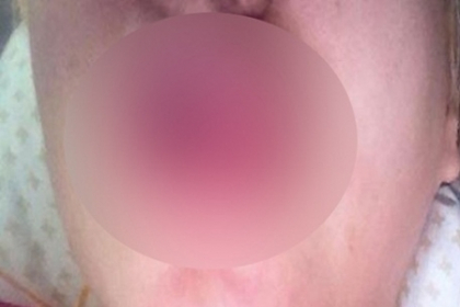 Cele mai socante buze de vedeta! O romanca a exagerat cu acidul hialuronic - FOTO Cele mai socante buze de vedeta! O romanca a exagerat cu acidul hialuronic - FOTO