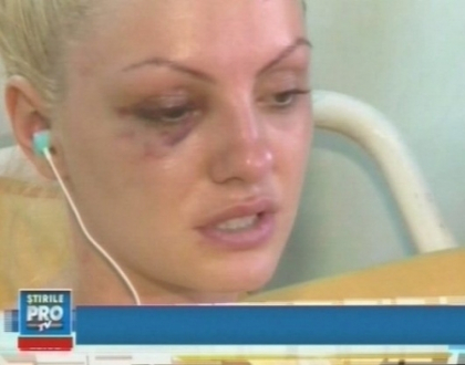 "Nu mai pot sa tac". Drama cumplita traita de Alexandra Stan: Ranile ar putea fi serioase