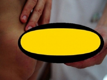 SOC in lumea medicala! Un baietel s-a nascut cu o COADA de 10 centimetri - FOTO