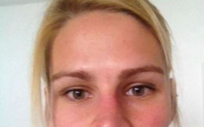 "Ganditi-va mai bine inainte de a face ce am facut eu". Cum arata tanara dupa ce si-a injectat botox "Ganditi-va mai bine inainte de a face ce am facut eu". Cum arata tanara dupa ce si-a injectat botox
