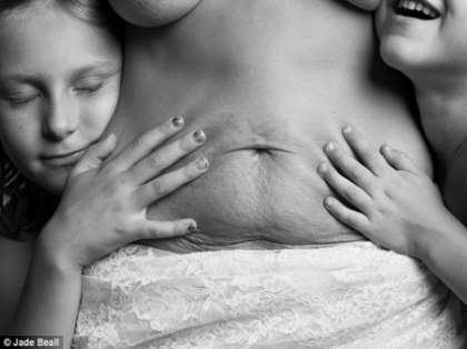 Detalii pe care nu le vezi in fiecare zi: cum arata corpul femeii dupa nastere "“ FOTO