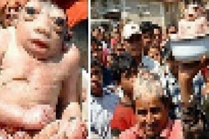 INFIORATOR: Toti au incremenit cand le-au vazut! Cele mai socante malformatii genetice - FOTO INFIORATOR: Toti au incremenit cand le-au vazut! Cele mai socante malformatii genetice - FOTO