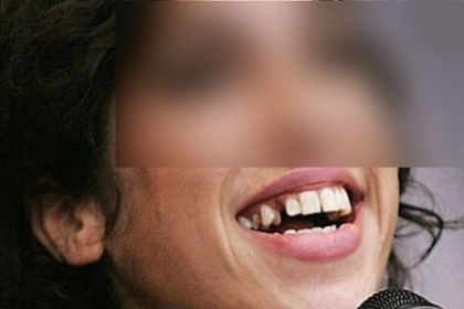 Sunt celebri, dar arata deplorabil! Cele MAI URATE vedete in viata - FOTO