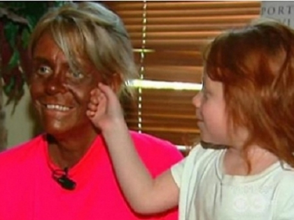 Amuzant! Ce se intampla atunci cand esti disperat sa te bronzezi - FOTO Amuzant! Ce se intampla atunci cand esti disperat sa te bronzezi - FOTO