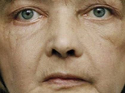 DRAMA din spatele acestui CHIP: a ajuns desfigurata dupa ce a fost muscata de propriul caine - FOTO DRAMA din spatele acestui CHIP: a ajuns desfigurata dupa ce a fost muscata de propriul caine - FOTO