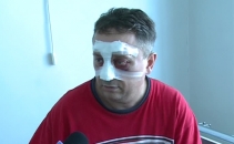 "Garaba NU a avut nasul fracturat". Avocatul soferului implicat in accident: A fost arestat fara temei "Garaba NU a avut nasul fracturat". Avocatul soferului implicat in accident: A fost arestat fara temei