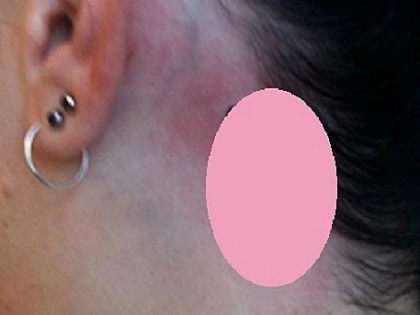 Ce-a fost in capul ei? Uite ce tatuaj neobinuit si-a facut aceasta tanara dupa ureche - FOTO Ce-a fost in capul ei? Uite ce tatuaj neobinuit si-a facut aceasta tanara dupa ureche - FOTO