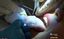"E ceva primitiv si inacceptabil". Metoda la care au recurs doua tinere ca sa slabeasca. VIDEO "E ceva primitiv si inacceptabil". Metoda la care au recurs doua tinere ca sa slabeasca. VIDEO