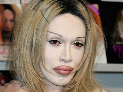 Vedeta-cameleon: Transformarile socante pe care le-a suferit Pete Burns de-a lungul timpului. Cum arata acum Vedeta-cameleon: Transformarile socante pe care le-a suferit Pete Burns de-a lungul timpului. Cum arata acum