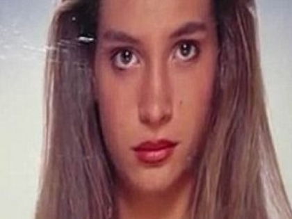 Cum s-a transformat acest model dupa ce a fost diagnosticat cu o boala rara de sange - FOTO Cum s-a transformat acest model dupa ce a fost diagnosticat cu o boala rara de sange - FOTO