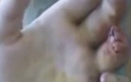 Efectele ingrozitoare ale drogului Krokodil. Medicii au fost ingroziti cand i-au vazut cum arata Efectele ingrozitoare ale drogului Krokodil. Medicii au fost ingroziti cand i-au vazut cum arata