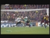 Rooney nu mai este chel! Implantul de par l-a costat 12 mii de euro Rooney nu mai este chel! Implantul de par l-a costat 12 mii de euro