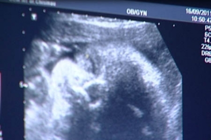 GREU DE CREZUT. O femeie sta internata la spital de 3 zile cu fatul MORT in burta GREU DE CREZUT. O femeie sta internata la spital de 3 zile cu fatul MORT in burta