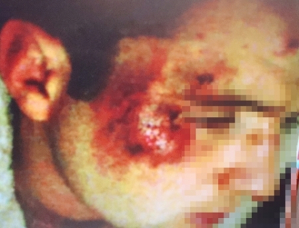 BATUTI pentru ca nu sunt comunisti? Doi tineri din satul Japca sustin ca au fost agresati. FOTO BATUTI pentru ca nu sunt comunisti? Doi tineri din satul Japca sustin ca au fost agresati. FOTO