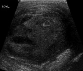FOTO. Medicii au ramas socati. N-o sa-ti vina sa crezi unde au gasit acest chip uman FOTO. Medicii au ramas socati. N-o sa-ti vina sa crezi unde au gasit acest chip uman